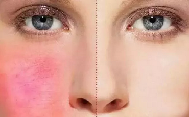 1509344316125046.png QQ图片20171030141558.png